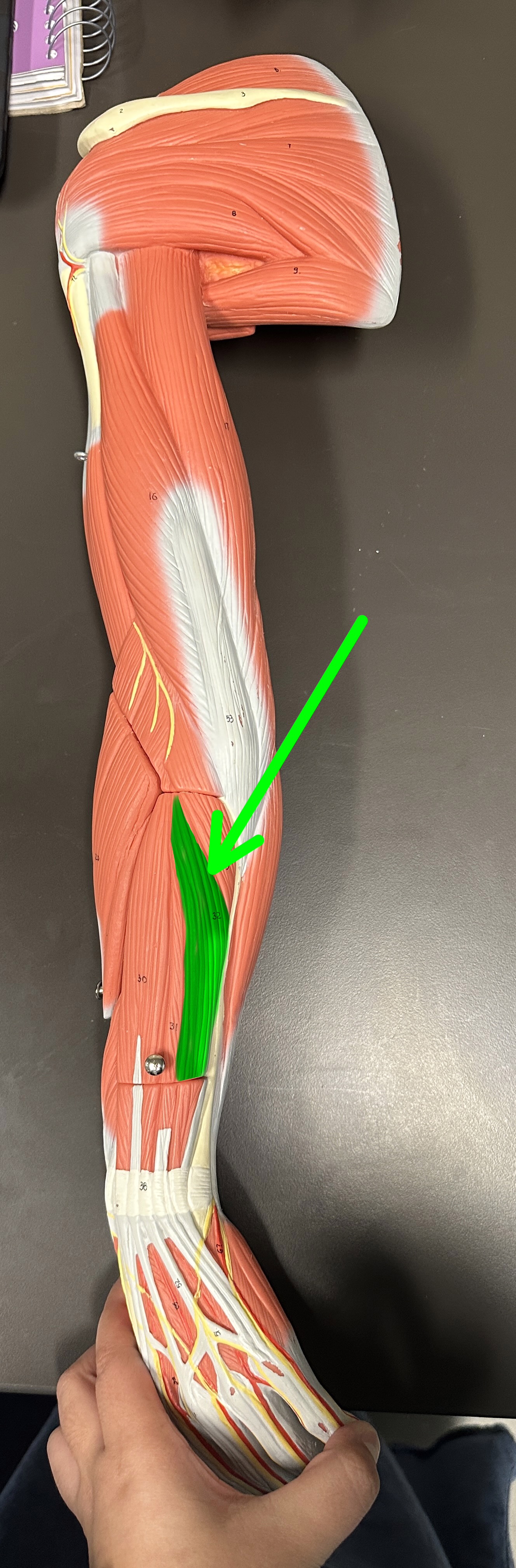 <p>What is the highlighted structure</p>
