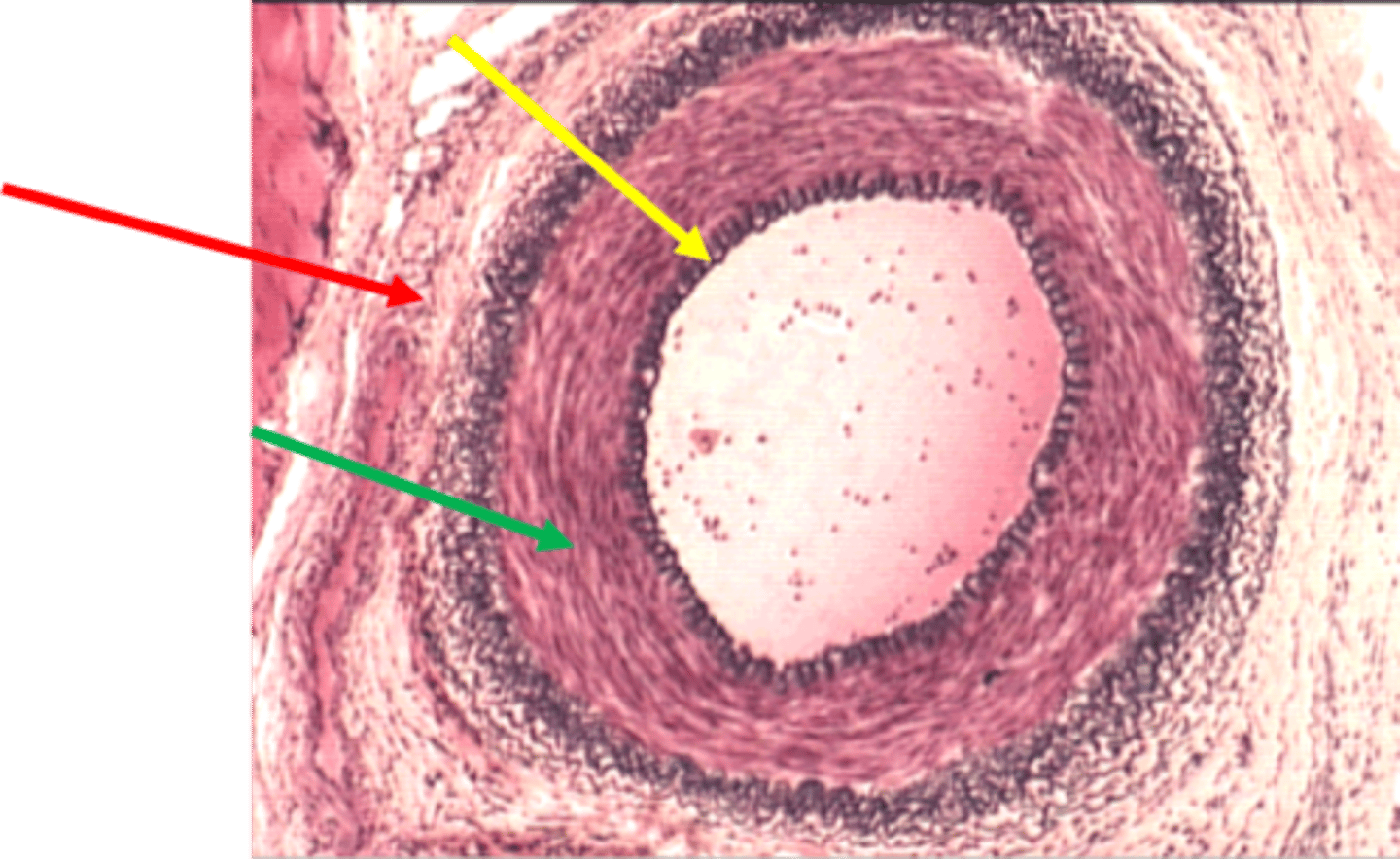 <p>ID the tissue</p><p>medium size (muscular) artery</p>