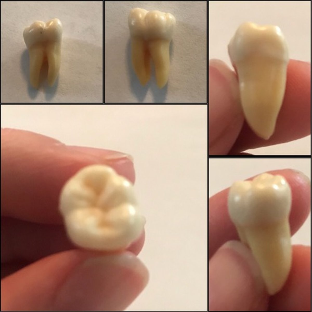 <p>What tooth is this ?</p>