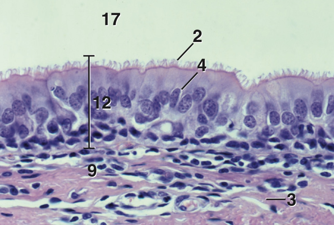 <p>What is the part of the epithelium indicated on the number 2?</p>