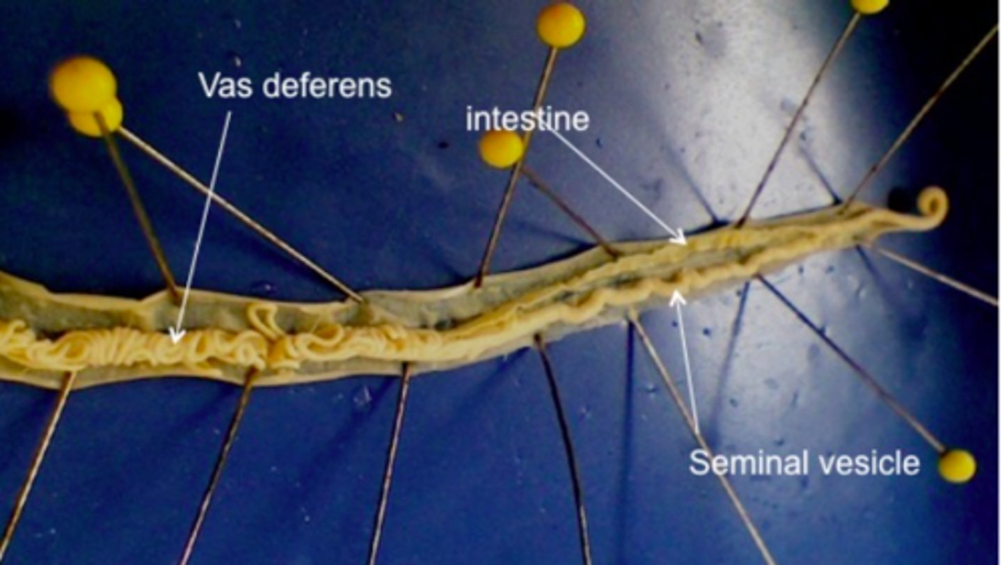 <p>Phylum Nematoda<br>intestine, vas deferens, seminal vesicle</p>