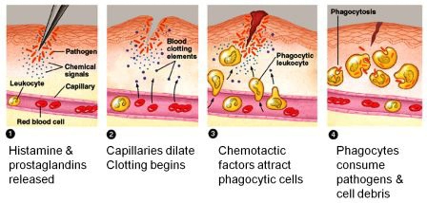 D515 IM Lecture 11 Antiinflammatory Drugs (Corticosteroids