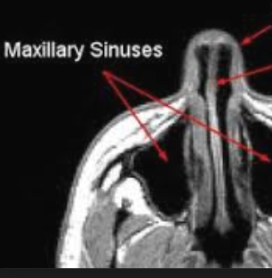 <p>what is this, its description and its appearance on images</p>