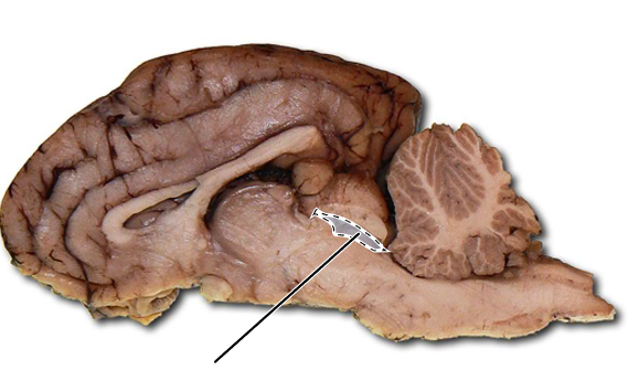 <p>Name the highlighted part of the brain.</p>