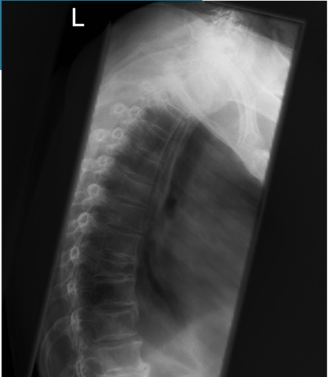 <p>Identify the positioning error</p>
