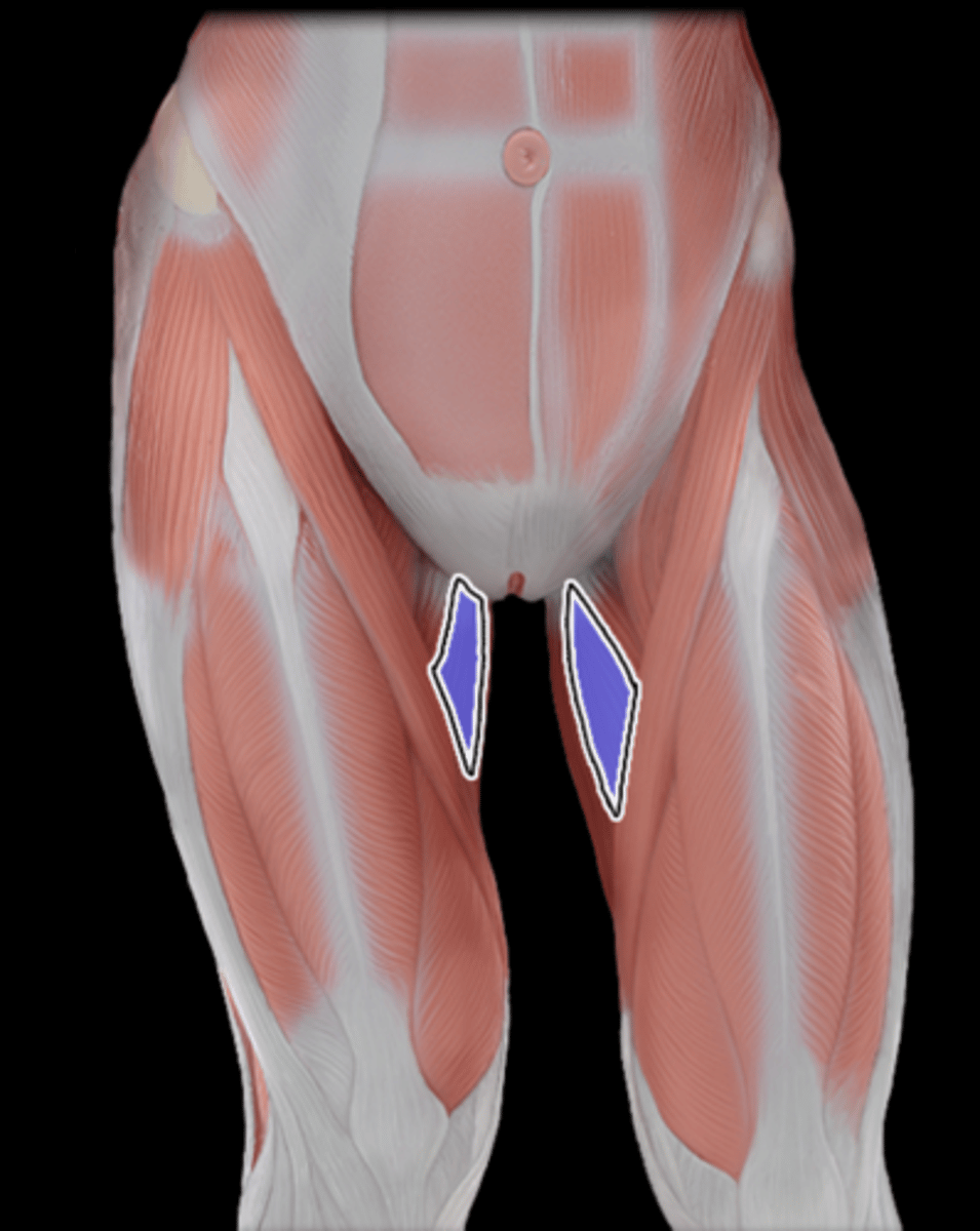 <p>What Muscle Is Highlighted?</p>