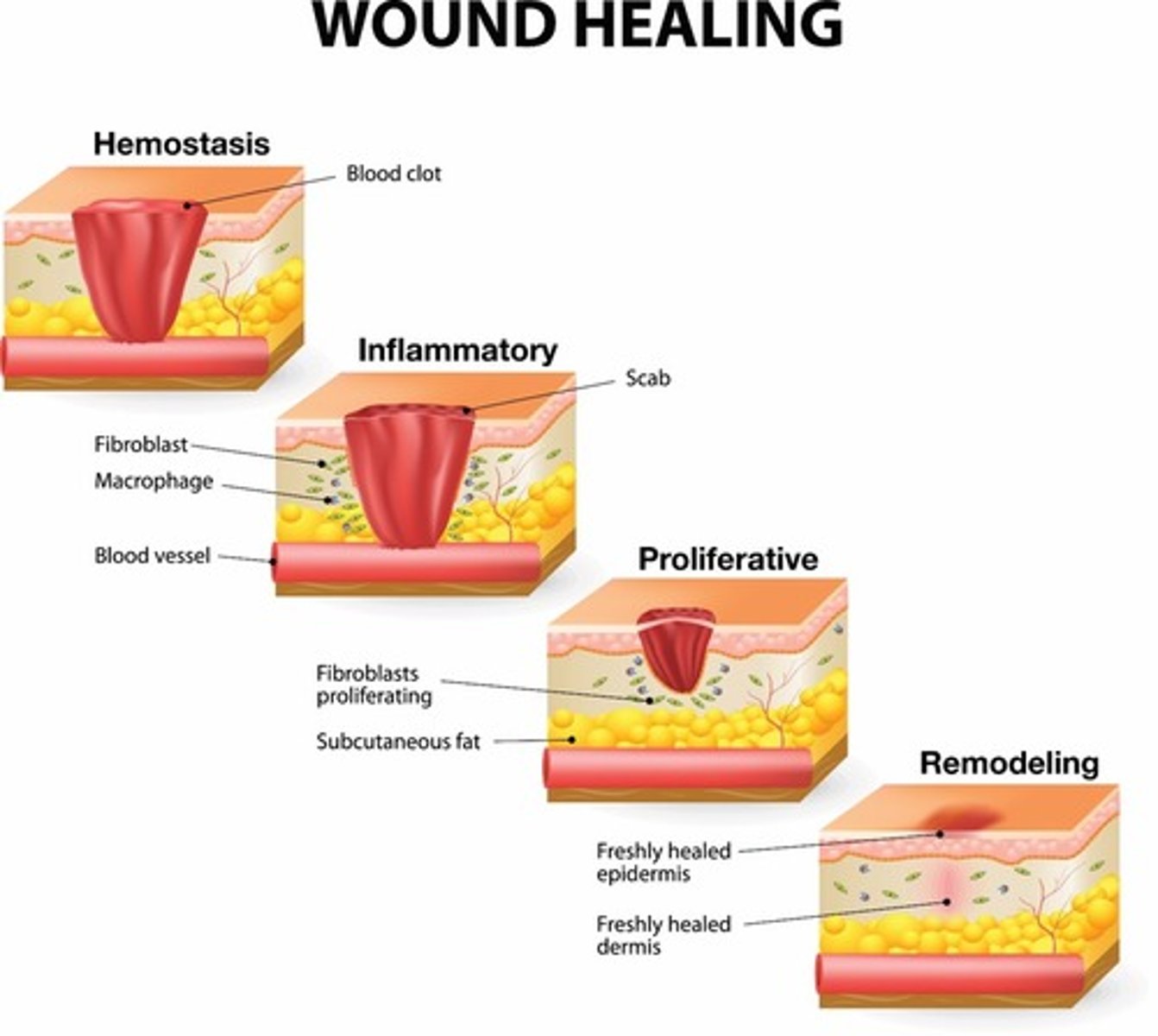 <p>Inflammatory (0-7)</p><p>-plt aggregation</p><p>-clotting cascade</p><p>-mast cell degran</p>