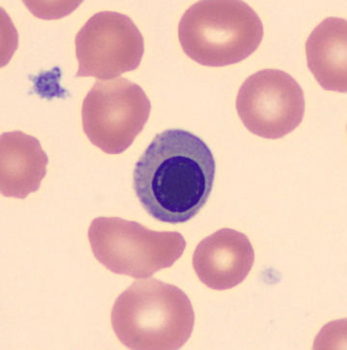 <p>(RBC inclusions)</p><p>RBC's that have not completed maturation and still have a nucleus</p>
