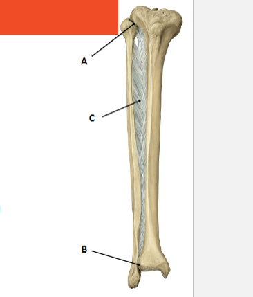 <p>Name the joint structures between the Tibia and Fibula: </p>