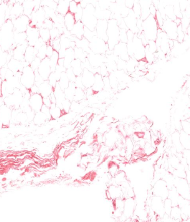 <p>type of connective tissue, notice small amounts of pink/red wispy fibers</p>