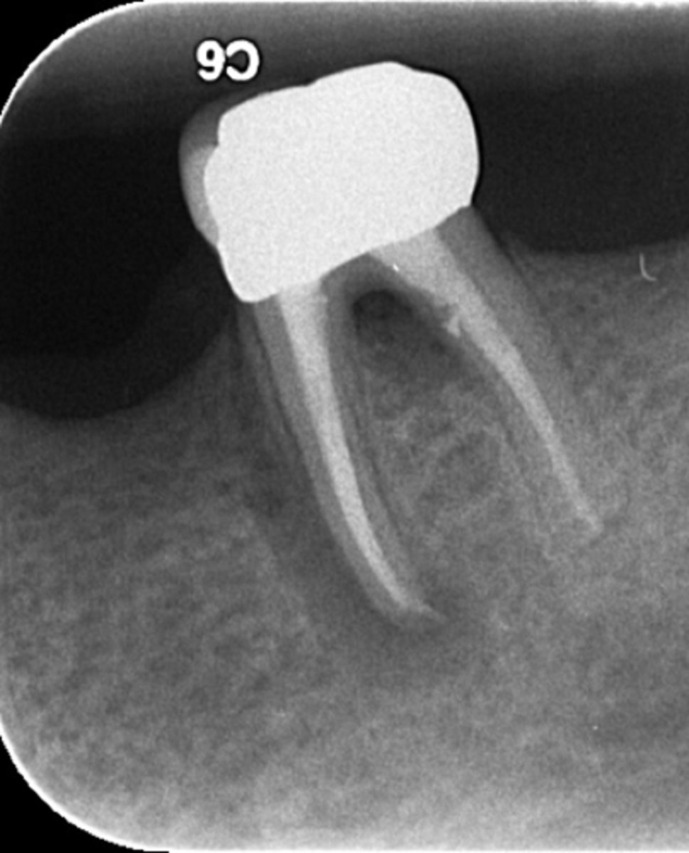 <p>ID the problem:</p>