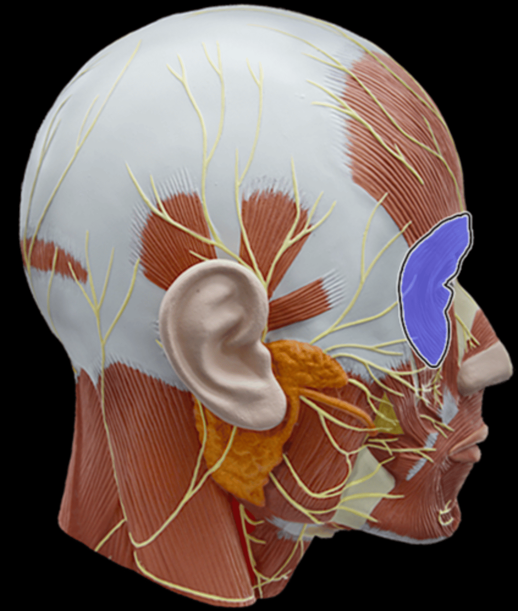<p>What Muscle Is Highlighted?</p>