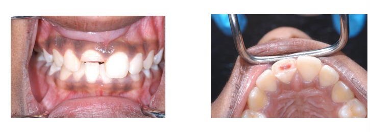 <p>What procedure does this child require?</p>