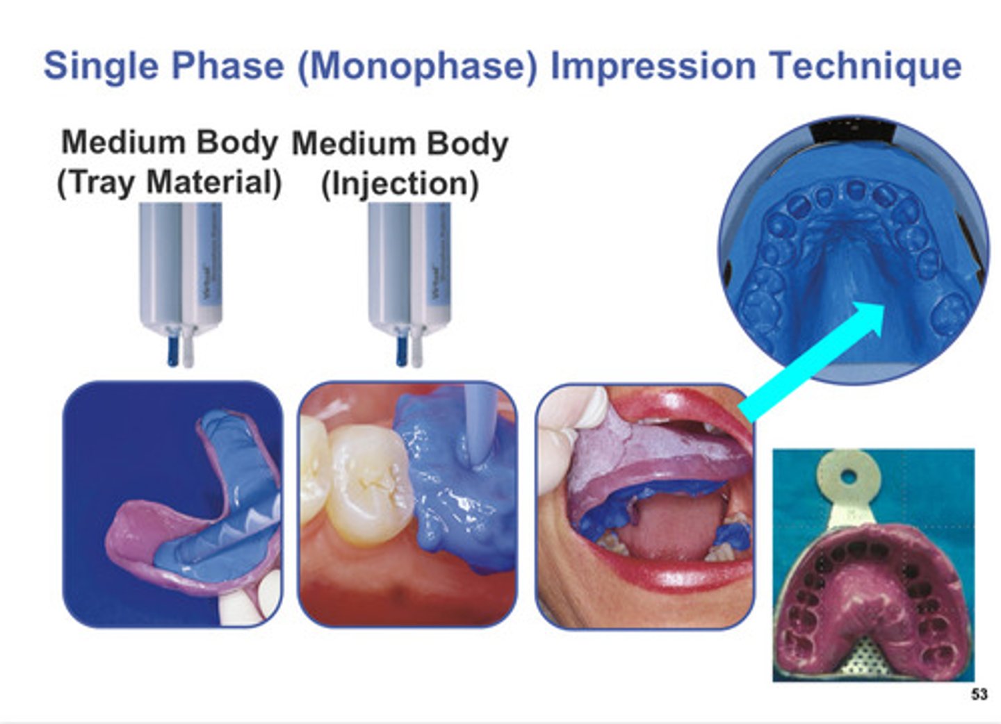<p>Medium body: put into tray and pt mouth, then take impression</p>