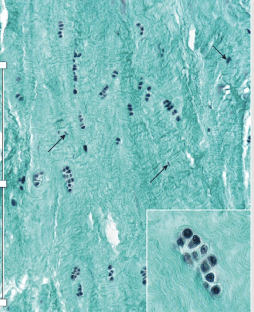 <p>What do regions with fibrocartilage that contain fibroblasts and type I collagen do? (2)</p>