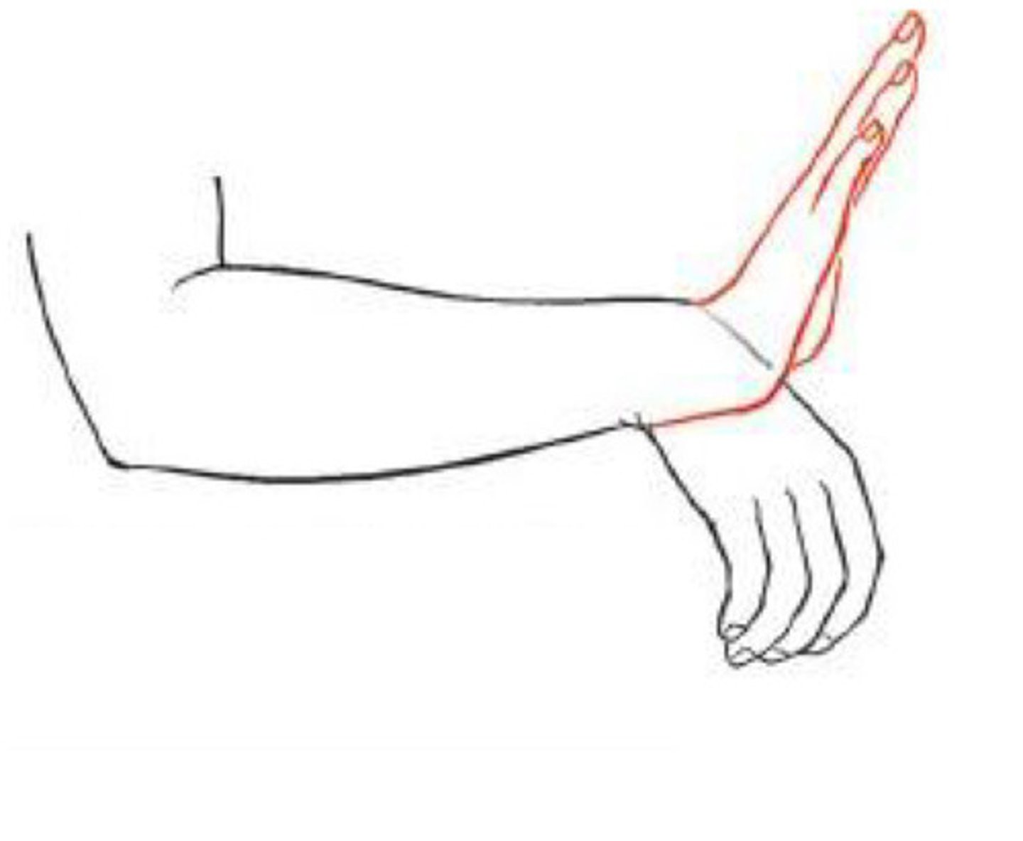 <p>What's the clinical significance of this picture? What nerve is assessed?</p>
