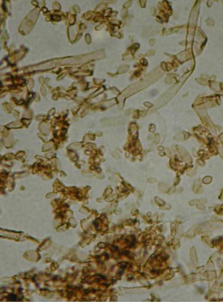 <p>Cladosporium sp. - zarodniki konidialne</p>