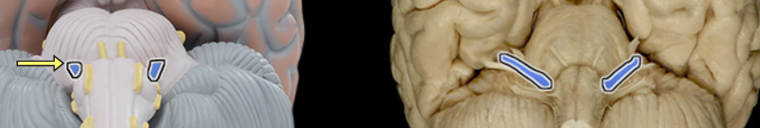 <p>Location:</p><ul><li><p>Posterior cranial fossa</p></li><li><p>Facial canal</p></li><li><p>Middle ear</p></li><li><p>Face</p></li><li><p>Infratemporal fossa</p></li><li><p>Oral cavity</p></li></ul><p>Composition:</p><ul><li><p>Motor</p></li><li><p>General sensation</p></li><li><p>Special sensation</p></li><li><p>Parasympathetic</p></li></ul><p>Motor:</p><ul><li><p>Muscles of facial expression</p></li><li><p>Posterior belly of digastric muscle</p></li><li><p>Stylohyoid muscle</p></li><li><p>Stapedius muscle</p></li></ul><p>General sensation:</p><ul><li><p>Small area of skin of auricle of ear</p></li></ul><p>Special sensation:</p><ul><li><p>Taste from anterior 2/3 of tongue</p></li><li><p>Taste from palate</p></li></ul><p>Parasympathetic:</p><ul><li><p>Lacrimal gland</p></li><li><p>Submandibular and sublingual salivary glands</p></li><li><p>Mucous glands of nasal cavity, paranasal sinuses, and palate</p></li></ul><p>CNS connection:</p><ul><li><p>Motor: pons (motor nucleus of facial nerve)</p></li><li><p>General sensation: medulla oblongata (spinal trigeminal nucleus)</p></li><li><p>Special sensation: medulla oblongata (nucleus of solitary tract)</p></li><li><p>Parasympathetic: medulla oblongata (superior salivatory nucleus</p></li></ul><p>Sensory ganglion:</p><ul><li><p>Geniculate</p></li></ul><p>Cranial foramina:</p><ul><li><p>Internal acoustic meatus</p></li><li><p>Pterygomaxillary fissure</p></li><li><p>Stylomastoid foramen</p></li></ul><p>Also known as:</p><ul><li><p>CN VII</p></li></ul><p>Comment:</p><ul><li><p>Special sensory and parasympathetic axons, together, form the chorda tympani nerve</p></li><li><p>Postganglionic parasympathetic nerve cell bodies located in pterygopalatine and submandibular ganglia</p></li></ul><p></p>