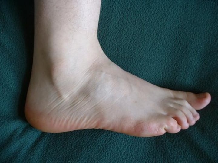 <p>the foot</p>