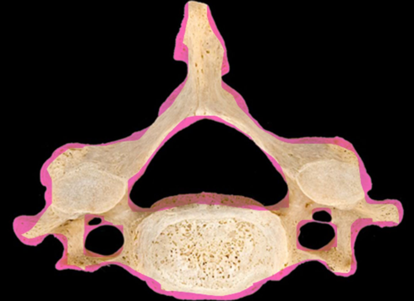 <p>name the individual vertebrae</p>