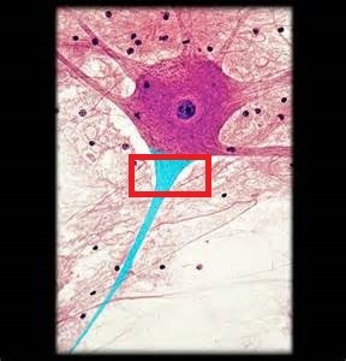 <p>Long fiber that transmits signals away from the cell body.</p>