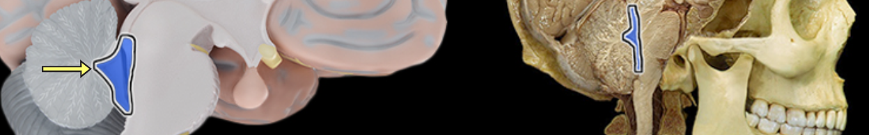 <p>Fourth ventricle</p>