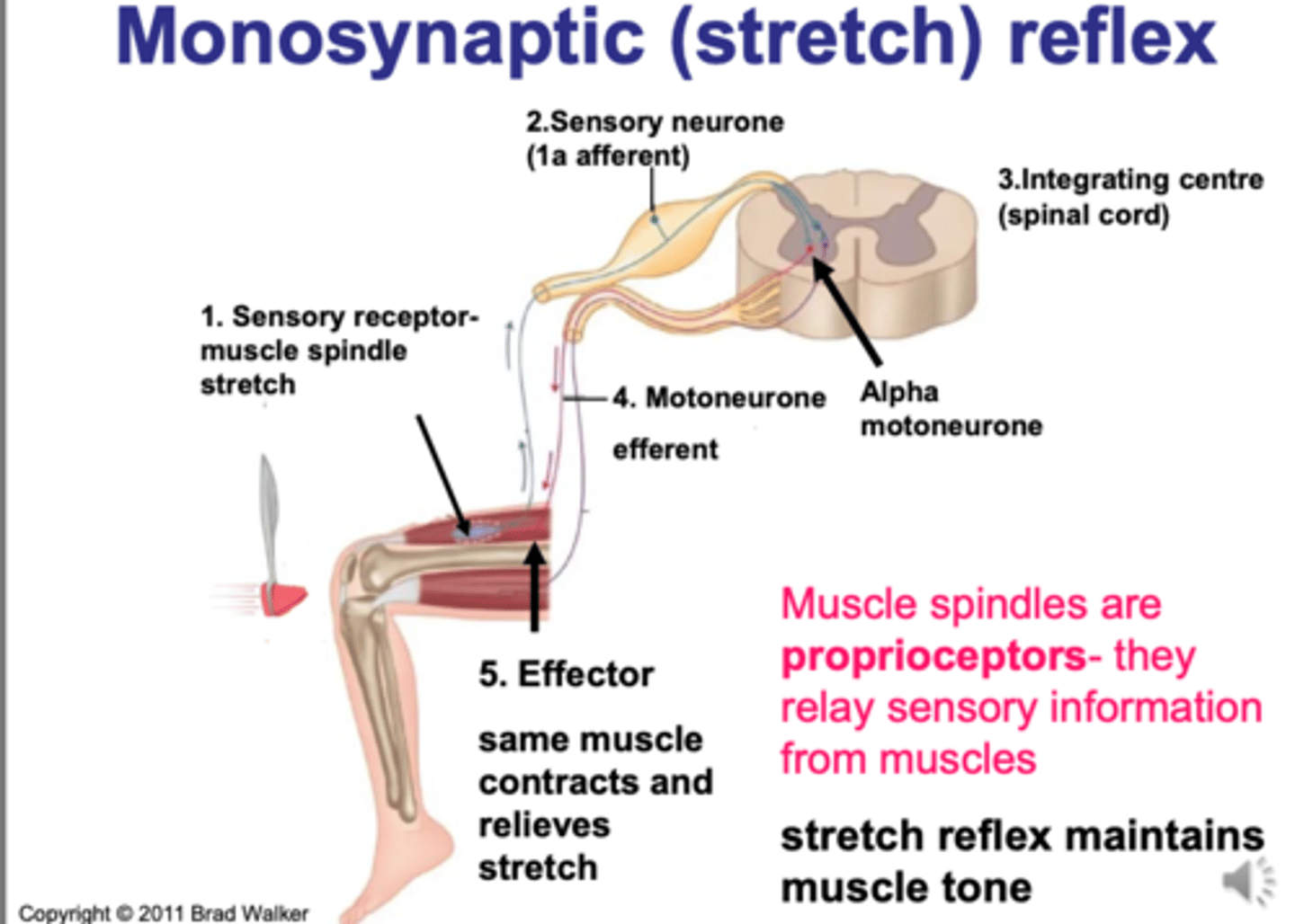 <p>1. stimulus (ex. mallet hitting knee)</p><p>2. Quick stretch of tendon activates muscle spindle</p><p>3. Afferents send signal to spinal cord</p><p>4..Synapse with alpha motor neurons, triggering efferents to muscle</p><p>5. Muscle contracts</p>