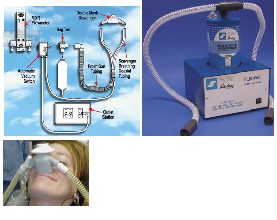 <p><span><span>exposure to ambient nitrous oxide be minimized through use of effective scavenging systems and periodic evaluation and maintenance of the delivery and scavenging systems </span></span></p><p><span><span>The major source of trace N2O that contaminates the ambient air in the dental office is caused by patients talking when nitrous oxide is being administered</span></span></p><p><span><span>Nitrous oxide scavenging unit controls N2O ambient air levels</span></span></p><p><span><span>Once the nitrous oxide flow is terminated, 100% oxygen should be delivered for 5  minutes </span></span></p><p><span><span>The patient must return to pre-treatment responsiveness before discharge</span></span></p>