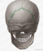 <p>parietal and occipital bone suture</p>