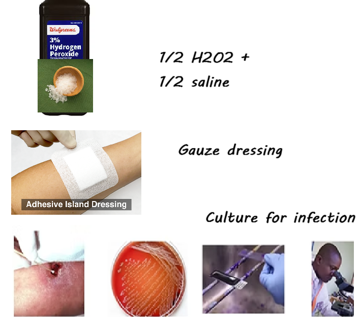 <ol><li><p>Cleanse area with:<strong> ½ Hydrogen Peroxide, ½ Saline</strong> (mix immediately prior to use)</p></li><li><p><strong>Gauze dressings </strong>for wound area</p></li><li><p>Area may need to be <strong>cultured for infection</strong> (i.e. take bacteria culture)</p></li></ol><p></p><p></p>