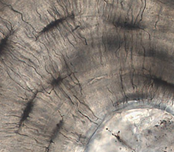 <p>darkly stained small channels</p>