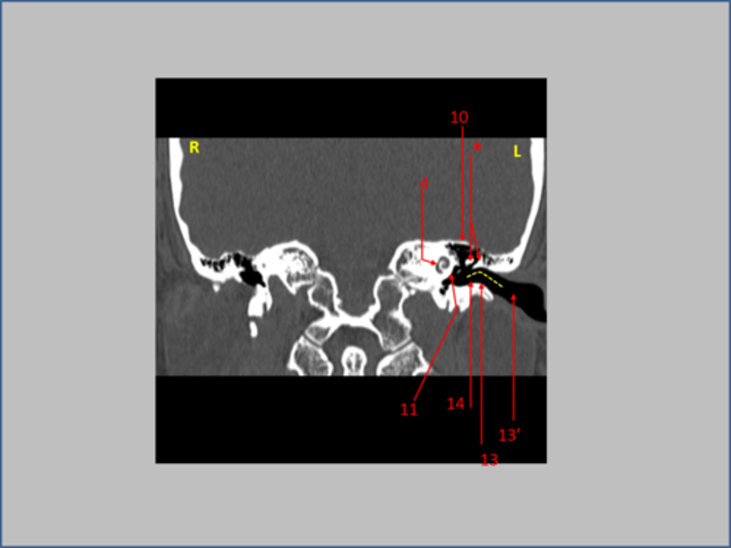 <p>13</p>
