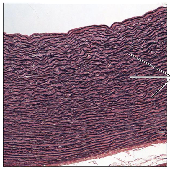 <p>What is this tissue, and where is it found?</p>