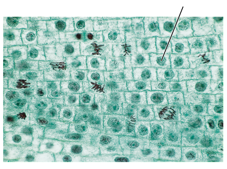 <p><span style="font-size: medium">At any instant in time, most cells will be in the _____ stage of the cell cycle.</span></p><p>(Longitudinal section of an onion root tip).</p>