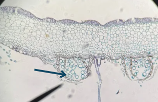 <p>The arrow is pointing to the ____ of the Marchantia Thallus.</p>