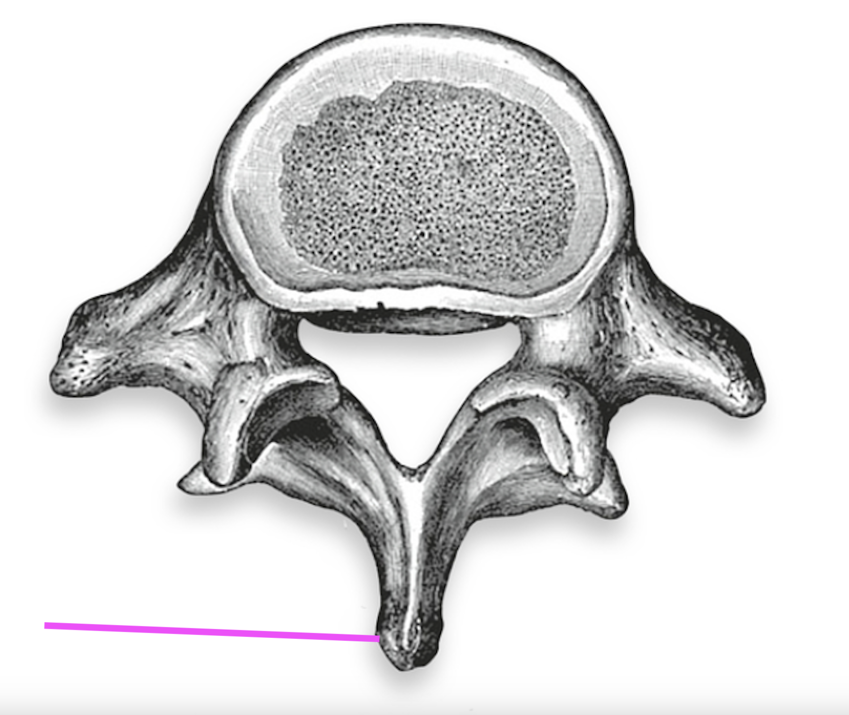 <p>What part of the vertebrae is this?</p>