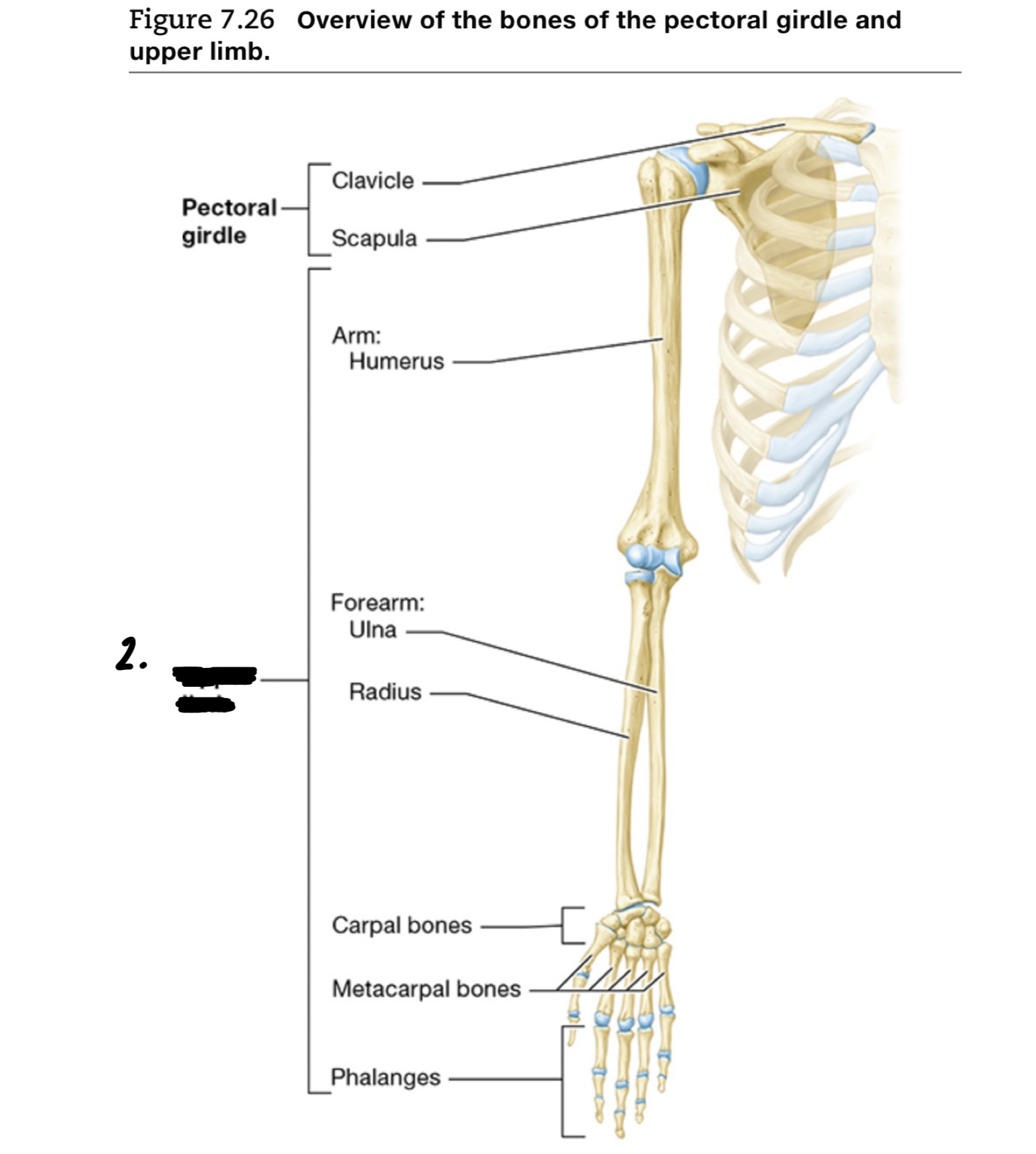 <p>What is #2?</p>