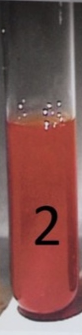 <p><span style="font-size: large;"><span>If the nitrate broth turns red after nitrate I and nitrate II are added, this color indicates a…</span></span></p>