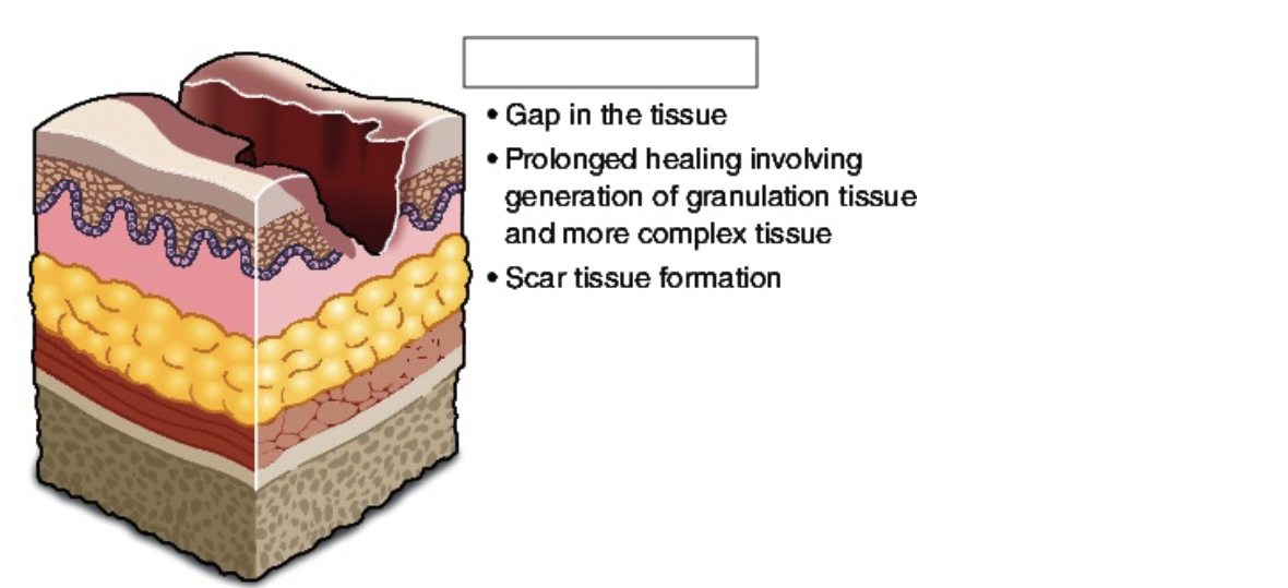 <p><span style="color: #ffffff">The image above best describes ___ wound healing</span></p>