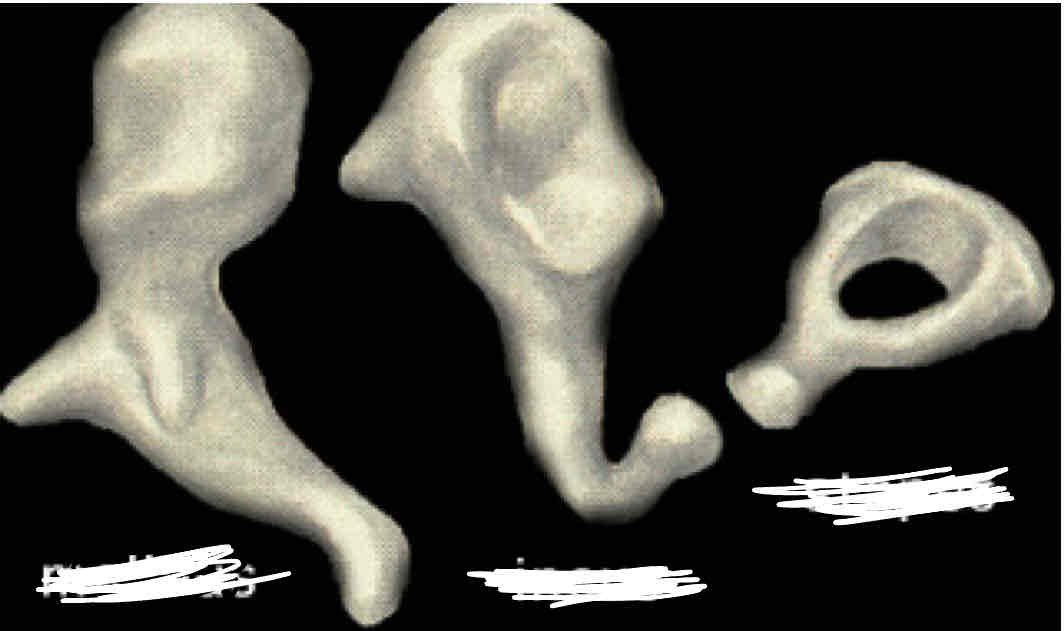<p>Auditory ossicles</p>