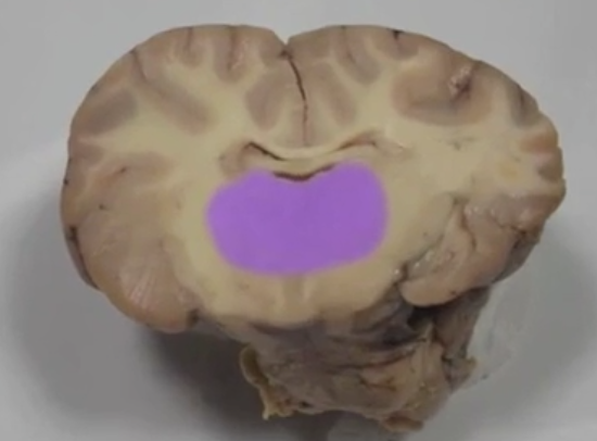 <p>Thalamus </p>