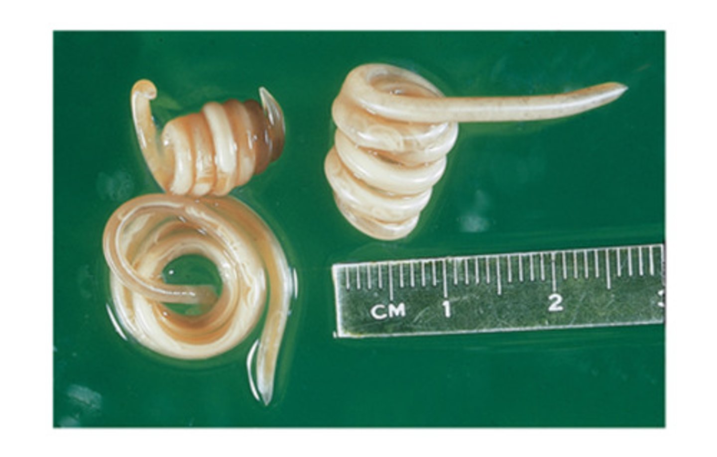 <p>These adult nematodes appear tightly coiled when passed in the feces but look like "spaghetti" when found in vomitus. These nematodes can NOT be</p>