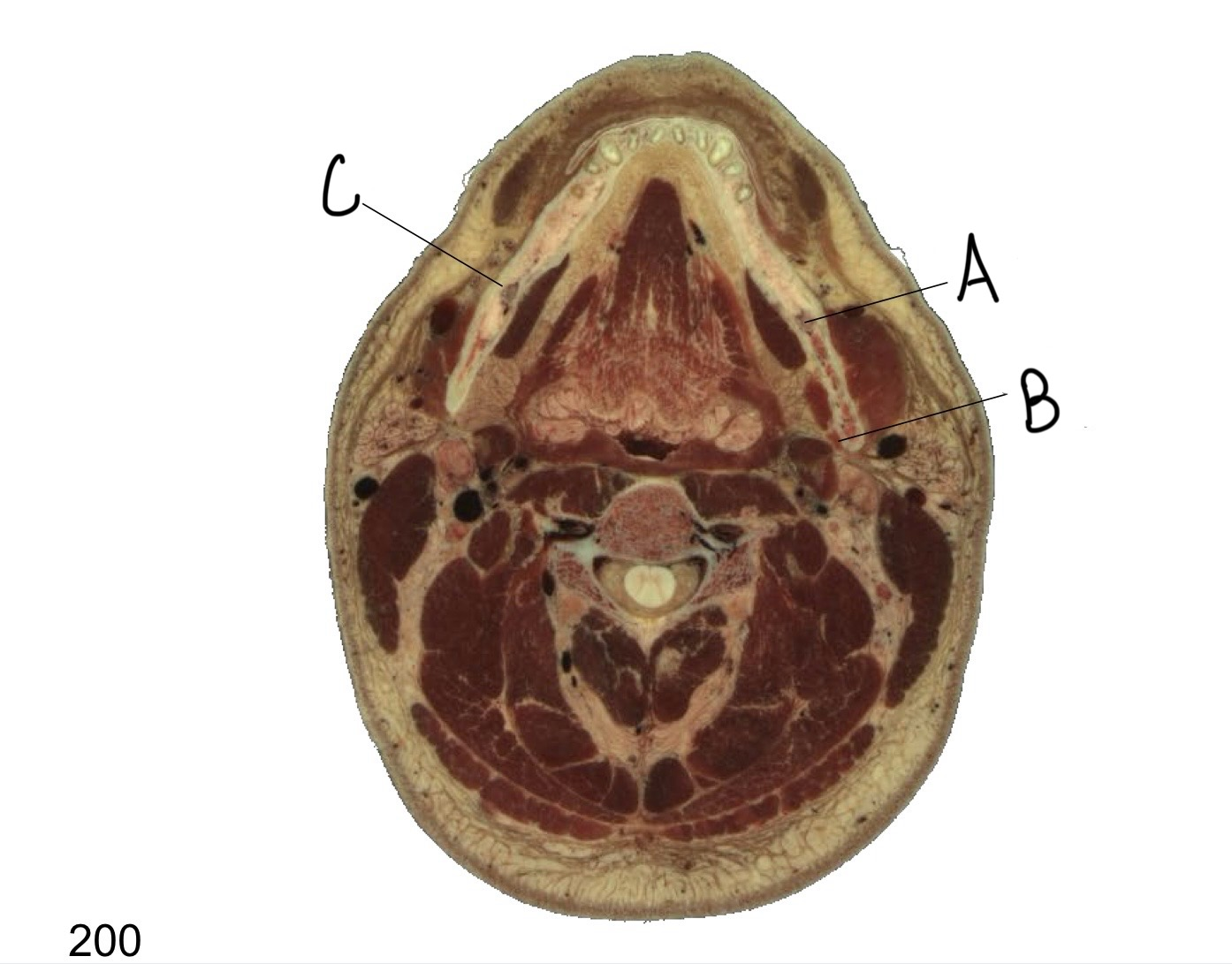 <p>what structure is labeled B?</p>