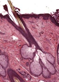 <p>Sebaceous (oil) glands</p>