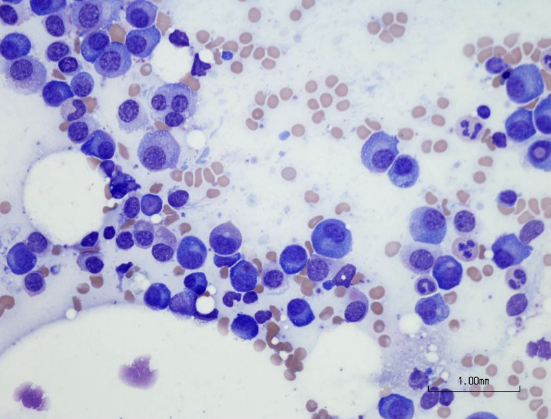 <p>plasma cells </p>