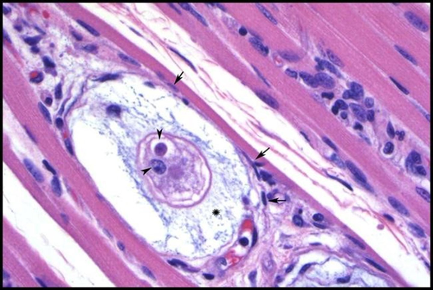 <p>Identify the parasite encysted in the muscle of a dog with myositis and anemia</p>