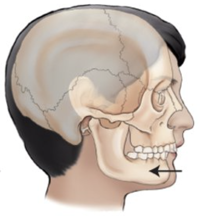 <p>__________ is movement backward or condition of being drawn back.</p>