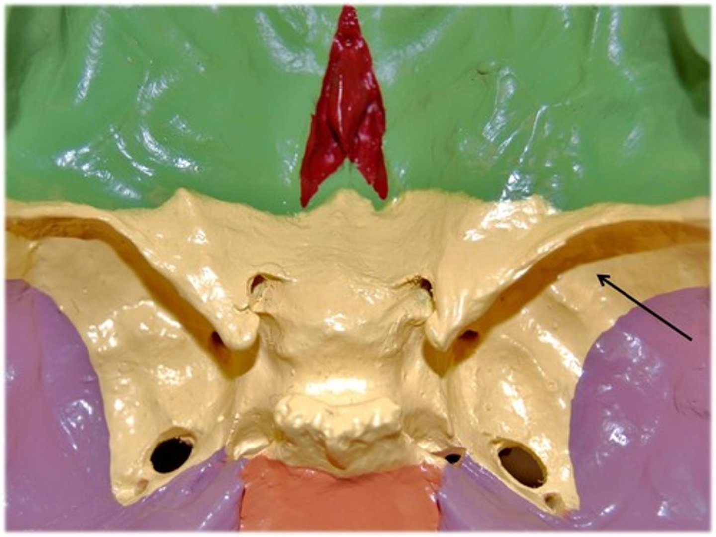 <p>Name this part of the sphenoid bone.</p>