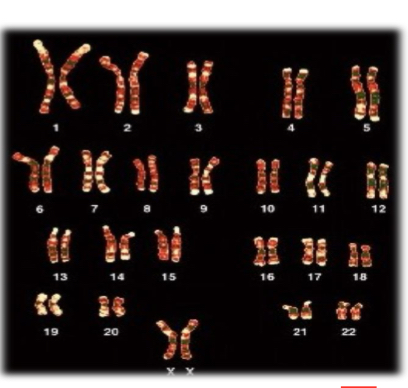 <p>Pairs of chromosomes with identical morphology.</p><p>In humans, one comes from the father and one from the mother.</p>