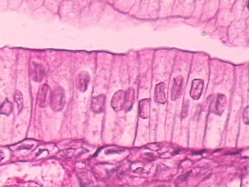 <p>single layer of elongated, rectangular shaped cells; found in surface lining of stomach and intestines.</p>